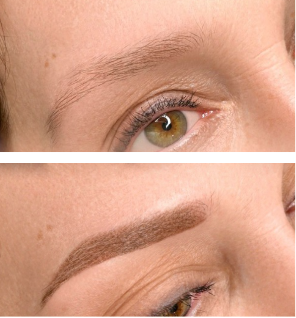 Augenbraue vor und nach der Powderbrows-Pigmentierung, zweite Ansicht
